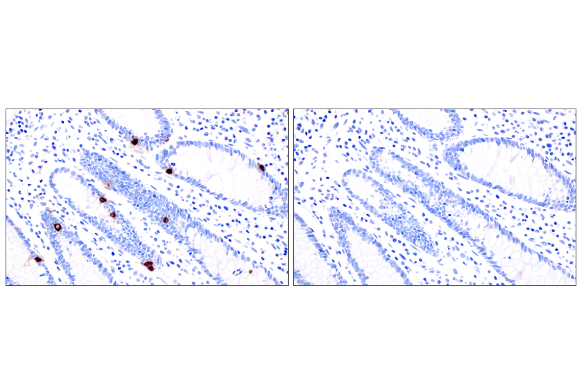 Immunohistochemistry Image 7: CHGA (F7D6H) Rabbit mAb