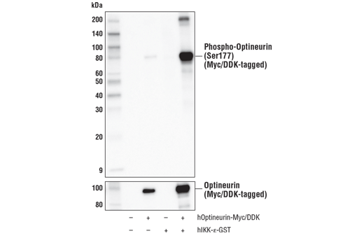 Western Blotting Image 3: Phospho-Optineurin (Ser177) Antibody