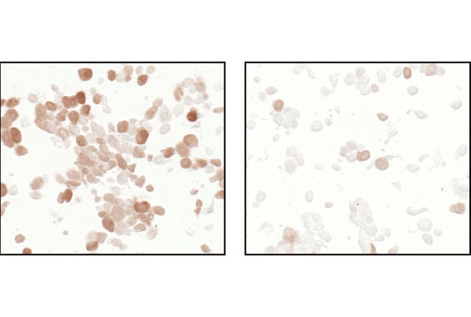 Immunohistochemistry Image 4: Phospho-4E-BP1 (Thr37/46) (236B4) Rabbit Monoclonal Antibody (BSA and Azide Free)