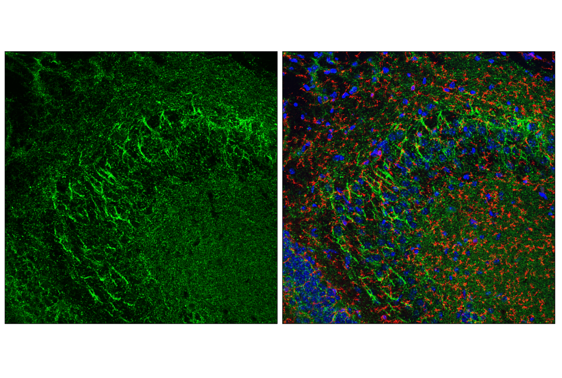 Immunofluorescence Image 1: VGAT Antibody
