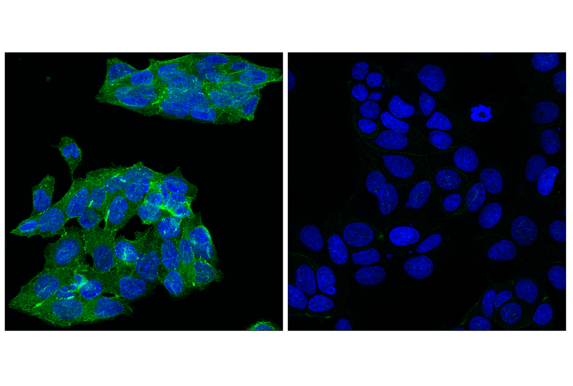 Immunofluorescence Image 1: Angiomotin (D2O4H) Rabbit Monoclonal Antibody