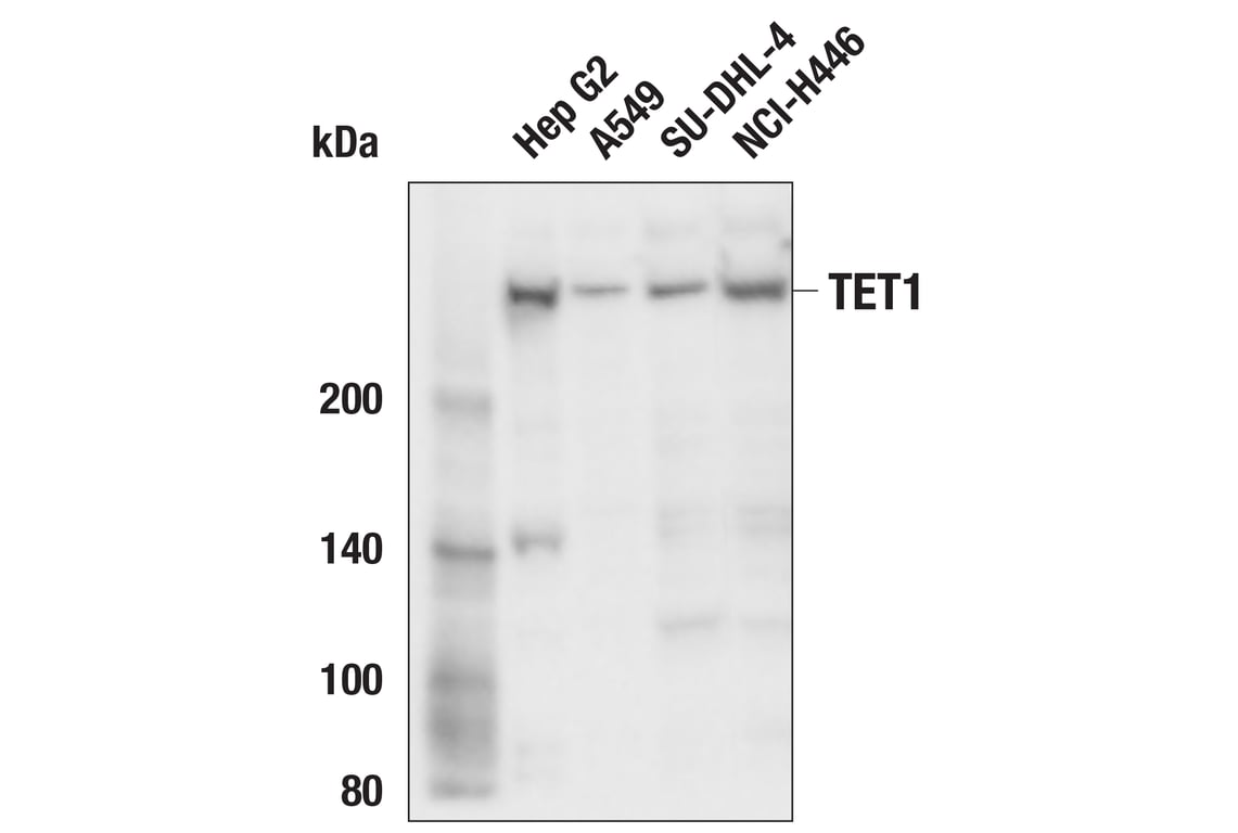 Western Blotting Image 2: TET1 (E5F1O) Rabbit Monoclonal Antibody