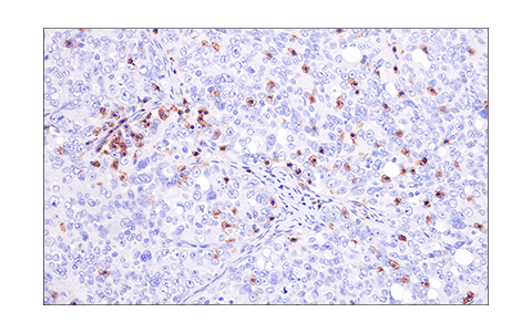 Immunohistochemistry Image 6: LAT (E3U6J) Rabbit Monoclonal Antibody