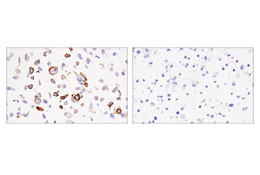 Immunohistochemistry Image 1: Keratin 5 (E2T4B) Rabbit Monoclonal Antibody (BSA and Azide Free)