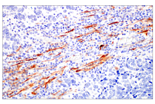 Immunohistochemistry Image 2: HSP20 (E6O7A) Rabbit Monoclonal Antibody