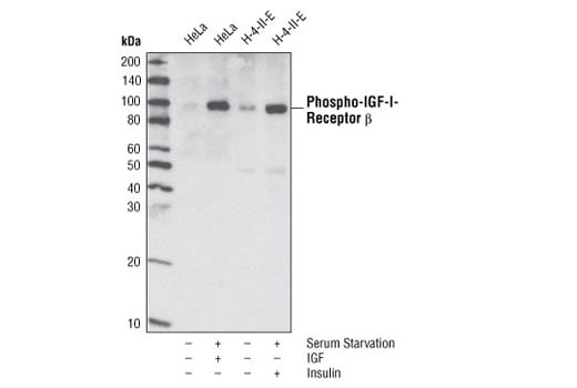 undefined Image 2: Phospho-Insulin/IGF Receptor Antibody Sampler Kit