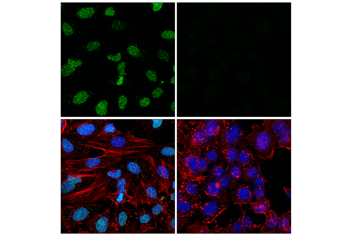 Immunofluorescence Image 2: Poly/Mono-ADP Ribose (D9P7Z) Rabbit mAb