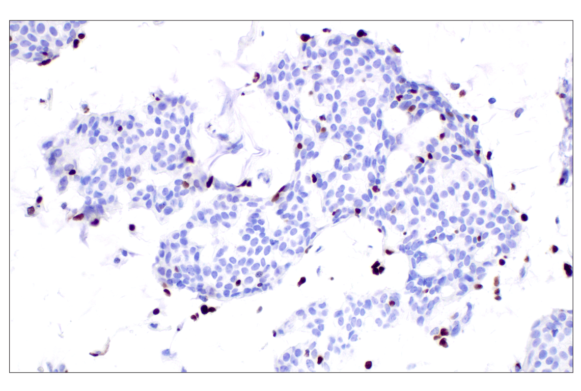 Immunohistochemistry Image 5: MNDA (3C1) Rat Monoclonal Antibody