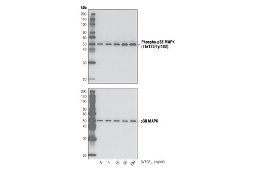 undefined Image 3: Human Vascular Endothelial Growth Factor-121 (hVEGF<sub>121</sub> )