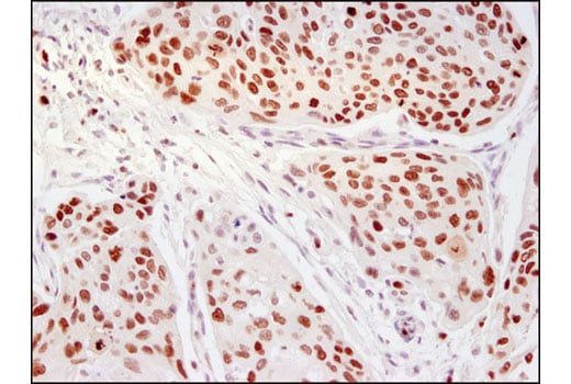 undefined Image 11: PhosphoPlus<sup>®</sup> Ezh2 (Thr311) Antibody Duet
