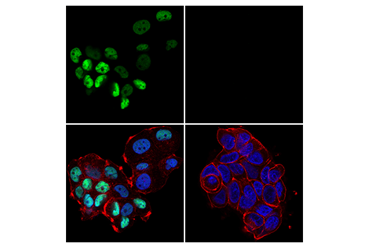 Immunofluorescence Image 1: SATB1 (E5Z3U) Rabbit Monoclonal Antibody
