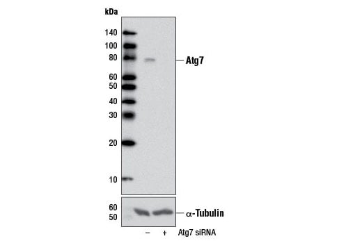 undefined Image 13: Autophagy Vesicle Elongation (LC3 Conjugation) Antibody Sampler Kit