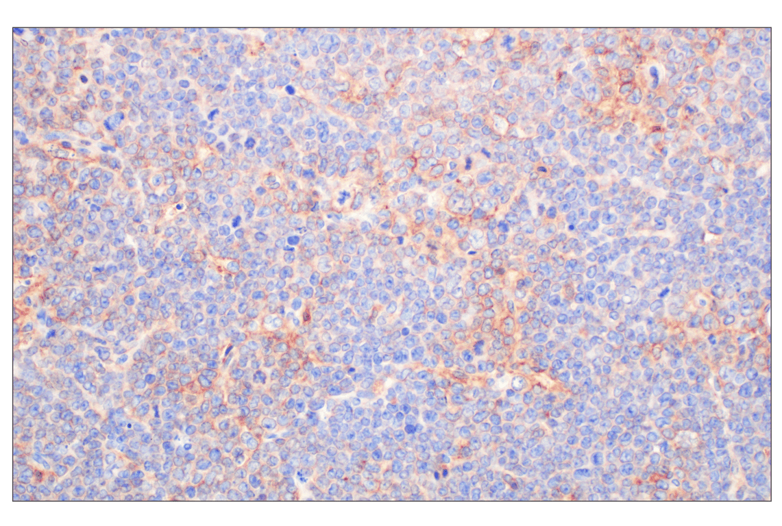 CCL3/MIP-1 alpha (F2M8Q) Rabbit Monoclonal Antibody (BSA and Azide