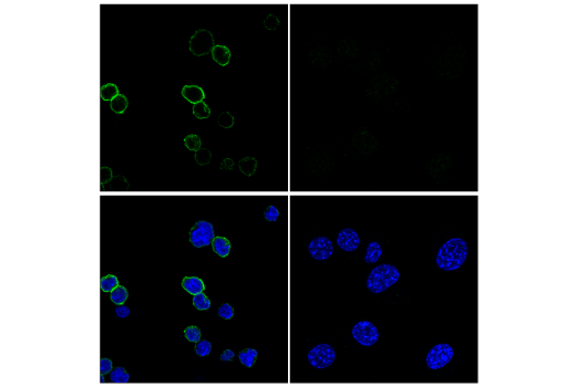 Immunofluorescence Image 1: TACI/TNFRSF13B/CD267 (E3P6X) Rabbit Monoclonal Antibody