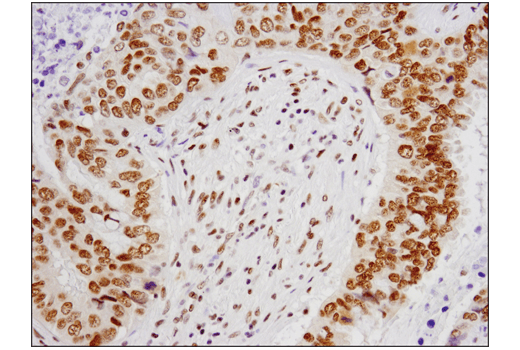 Immunohistochemistry Image 2: ESET (D4M8R) XP<sup>®</sup> Rabbit mAb