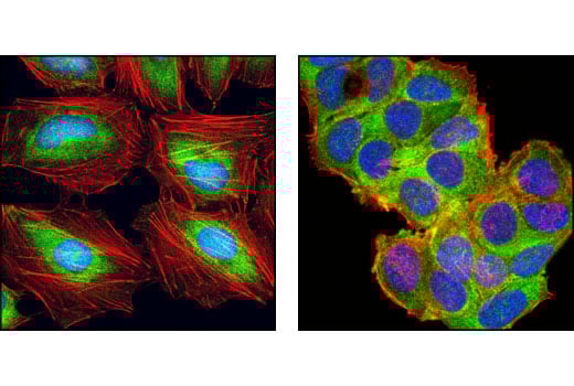 Immunofluorescence Image 1: eIF4H (D85F2) Rabbit Monoclonal Antibody