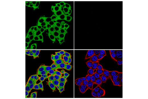 Immunofluorescence Image 1: KIF5B (E4A5A) Rabbit Monoclonal Antibody