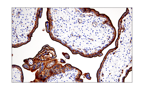 Immunohistochemistry Image 3: CD200 (E5I9V) Rabbit Monoclonal Antibody (BSA and Azide Free)