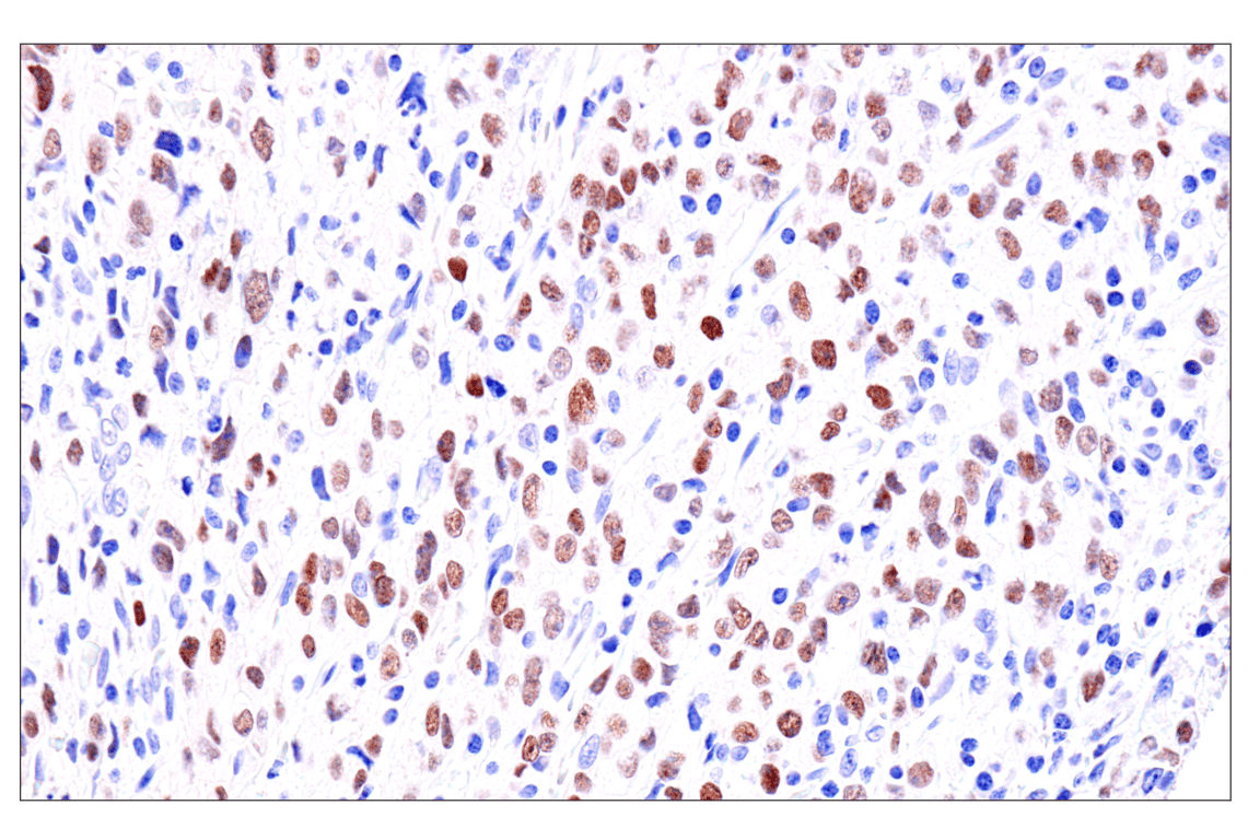 Immunohistochemistry Image 3: GATA-6 (D61E4) XP<sup>®</sup> Rabbit mAb