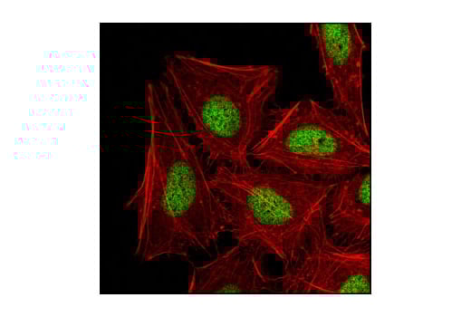 Immunofluorescence Image 1: Di-Methyl-Histone H3 (Lys27) (D18C8) Rabbit Monoclonal Antibody