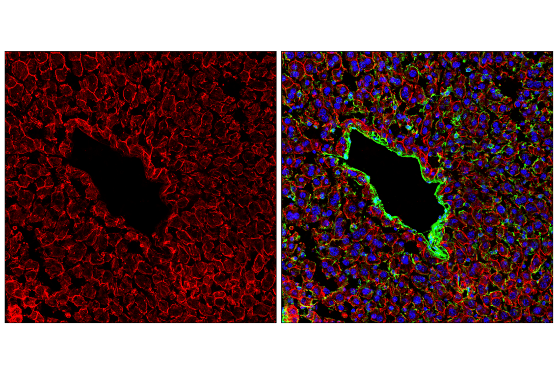 Immunofluorescence Image 1: Pan-Keratin (C11) Mouse Monoclonal Antibody (Alexa Fluor<sup>®</sup> 647 Conjugate)