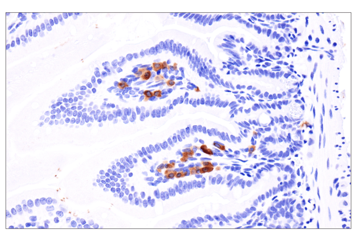 Immunohistochemistry Image 4: CD79A (F3Z1H) Rabbit Monoclonal Antibody