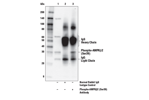 Immunoprecipitation Image 1: Phospho-AMPK beta2 (Ser39) Antibody