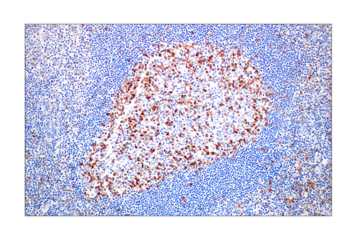 Immunohistochemistry Image 9: TIGIT (E5Y1W) Rabbit Monoclonal Antibody