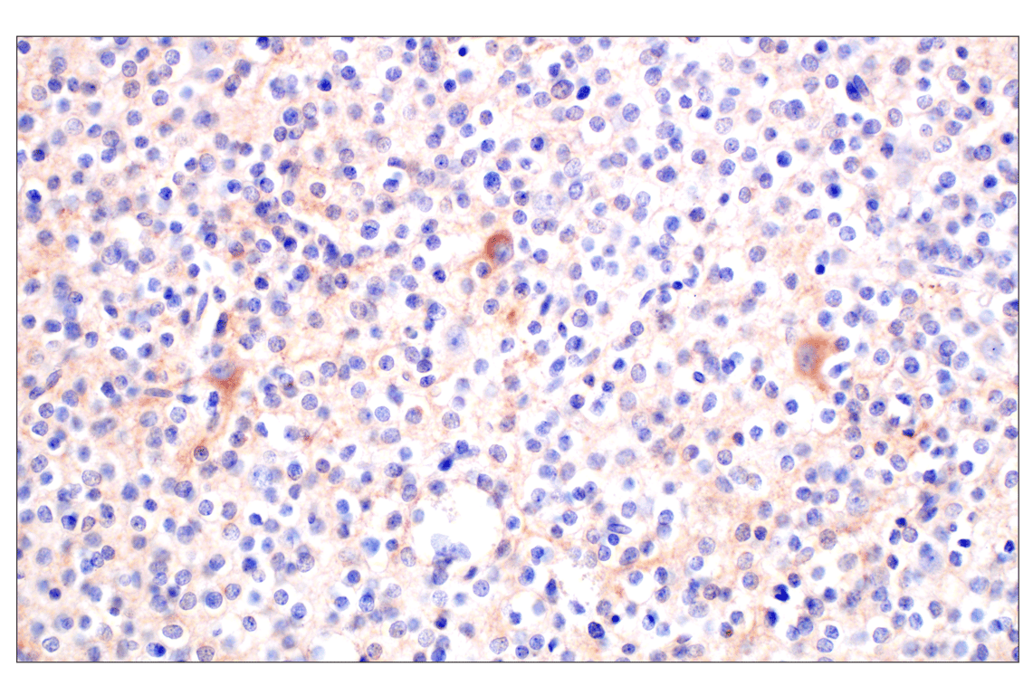 Immunohistochemistry Image 2: BACE1 (F4Z7X) Rabbit Monoclonal Antibody (BSA and Azide Free)
