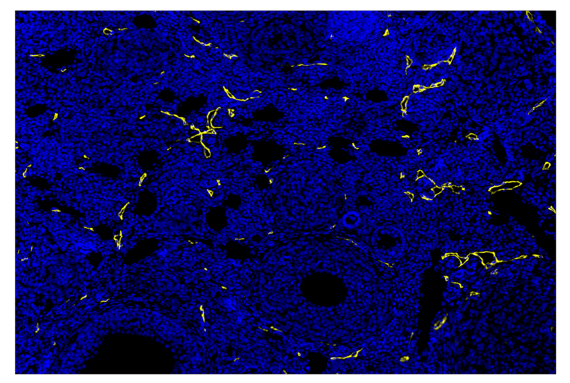 Immunohistochemistry Image 3: LYVE-1 (E5P8S) & CO-0148-488 SignalStar<sup>™</sup> Oligo-Antibody Pair
