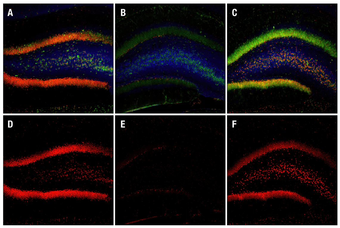 Immunofluorescence Image 1: Phospho-CREB (Ser133) (87G3) Rabbit Monoclonal Antibody (BSA and Azide Free)