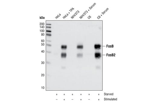 Western Blotting Image 1: FosB (5G4) Rabbit Monoclonal Antibody