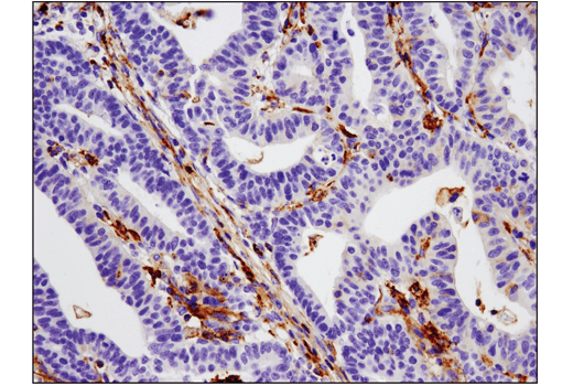 Immunohistochemistry Image 1: VISTA (D1L2G<sup>™</sup>) Rabbit Monoclonal Antibody (BSA and Azide Free)