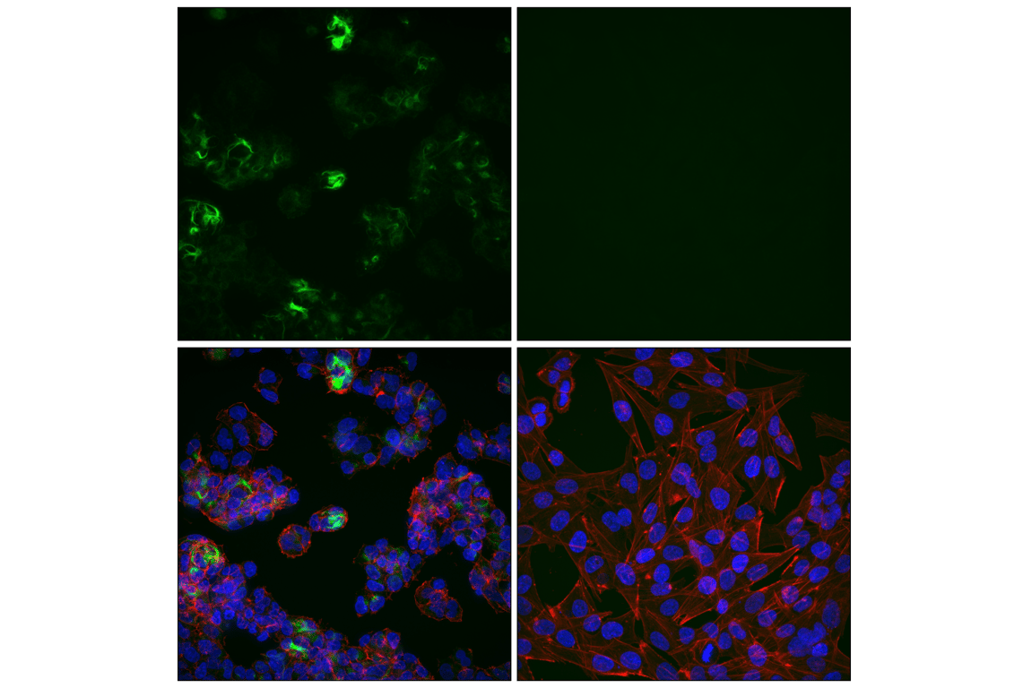 Immunofluorescence Image 1: Neurofilament-H (E9C9Z) Mouse Monoclonal Antibody