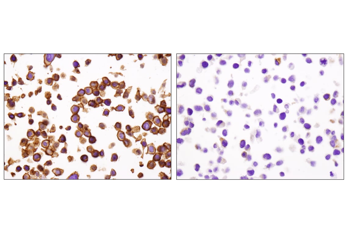 Immunohistochemistry Image 4: EpCAM (D9S3P) Rabbit Monoclonal Antibody (BSA and Azide Free)