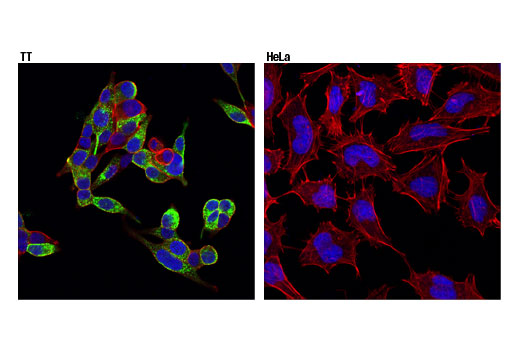 Immunofluorescence Image 1: CGRP (D5R8F) Rabbit Monoclonal Antibody