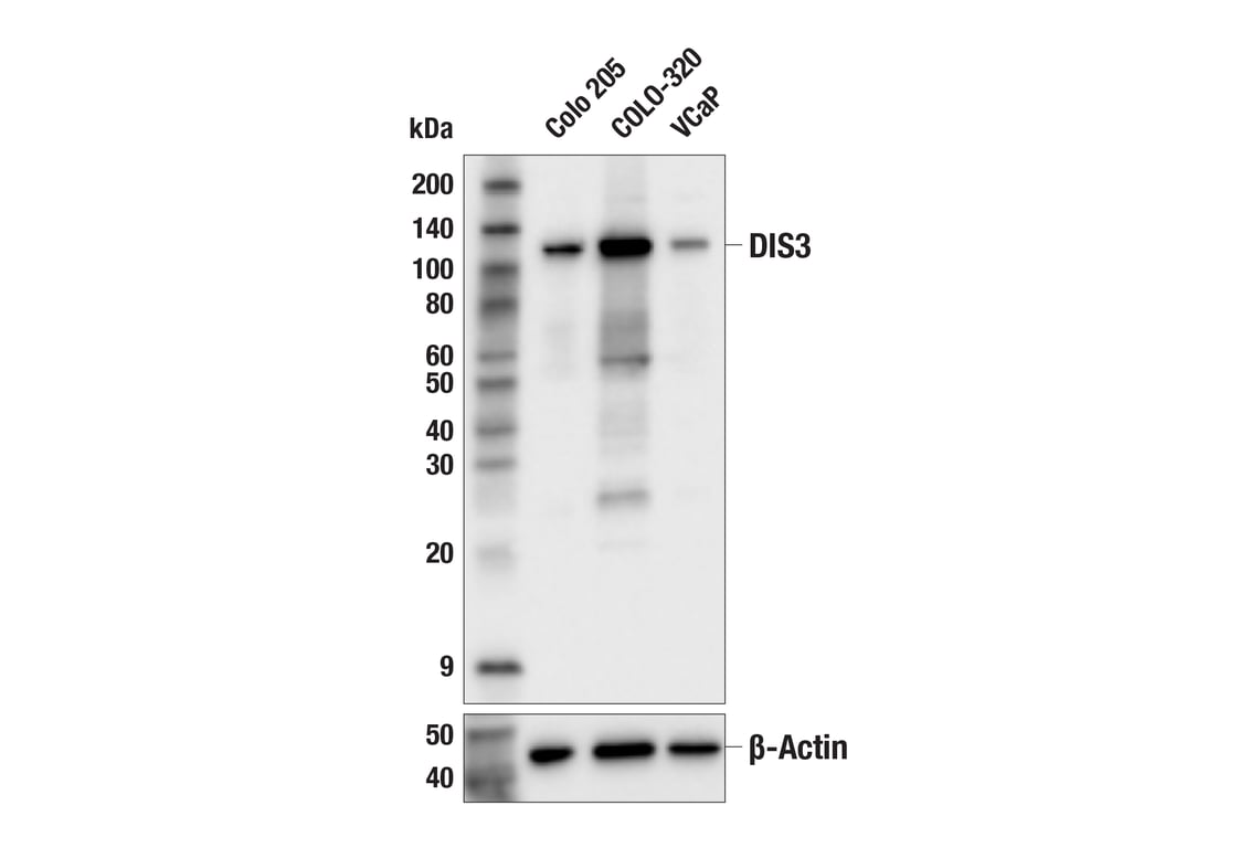 Western Blotting Image 1: DIS3 (E5I1Y) Rabbit mAb