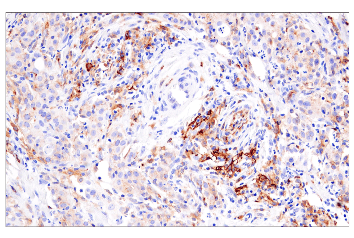 Immunohistochemistry Image 3: HLA-DRA (E9R2Q) Rabbit Monoclonal Antibody (BSA and Azide Free)