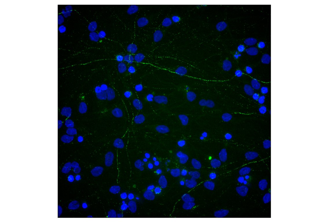 Immunofluorescence Image 2: Neurofilament-H (E7Z7G) Rabbit Monoclonal Antibody (BSA and Azide Free)