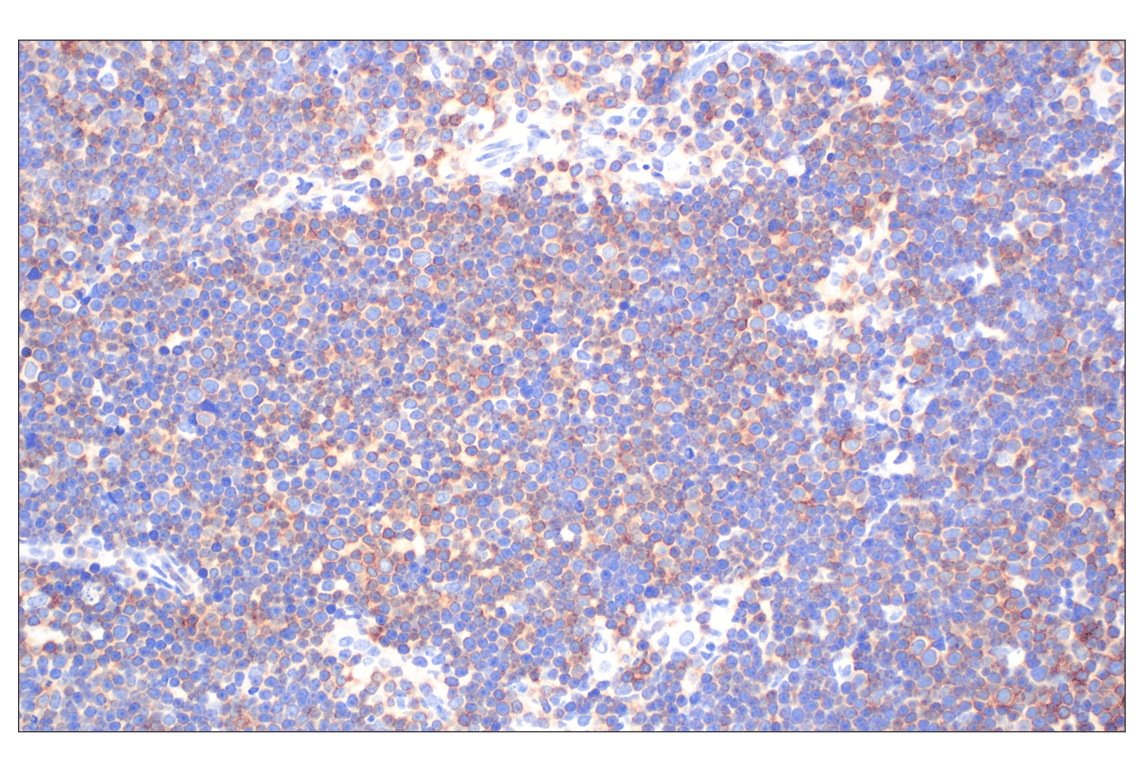Immunohistochemistry Image 5: CD27 (F3R2V) Rabbit Monoclonal Antibody