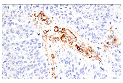 Immunohistochemistry Image 2: CD99 (PCB1) Mouse mAb