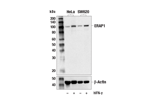 Western Blotting Image 2: ERAP1 (E6X1P) Rabbit Monoclonal Antibody