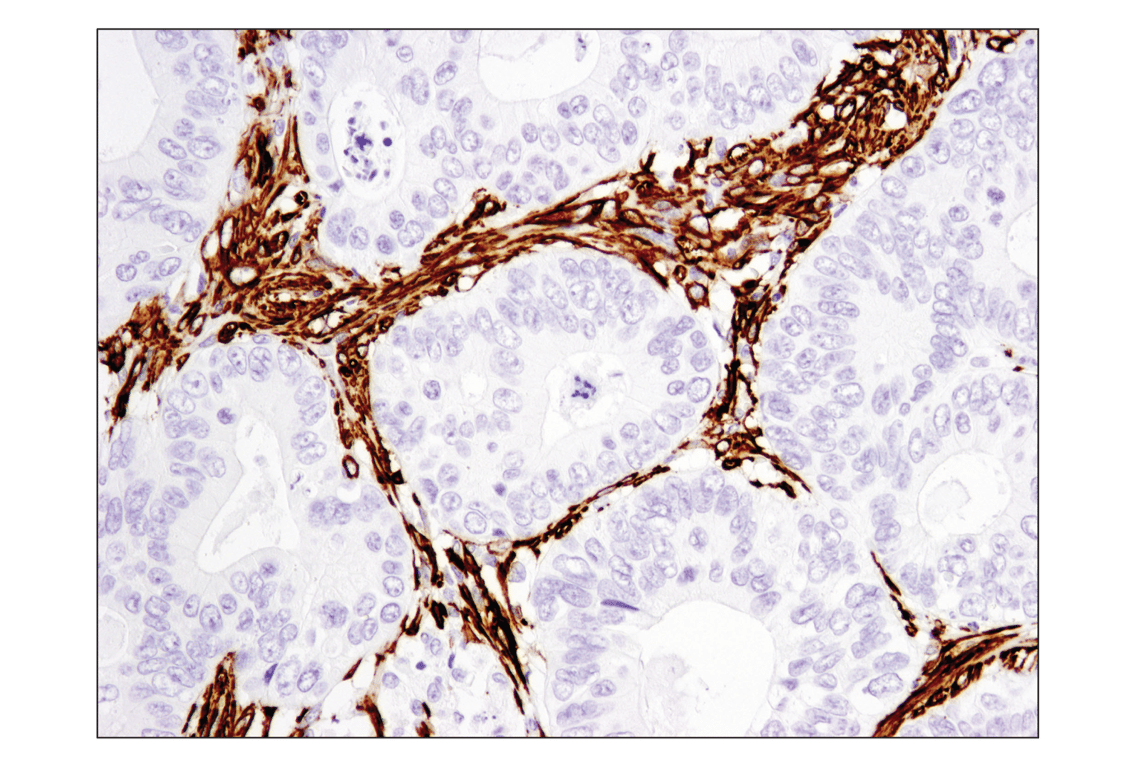 Immunohistochemistry Image 3: alpha-Smooth Muscle Actin (D4K9N) Rabbit Monoclonal Antibody (BSA and Azide Free)