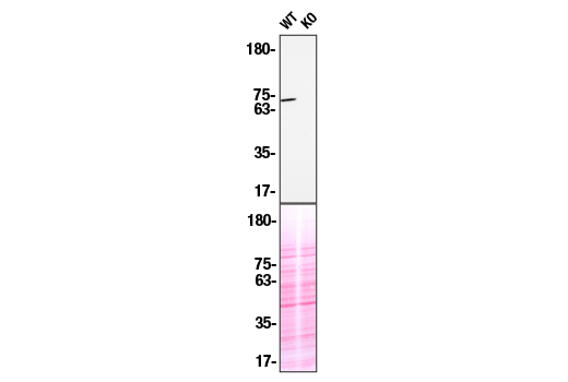Western Blotting Image 2: Syk (4D10) Mouse Monoclonal Antibody