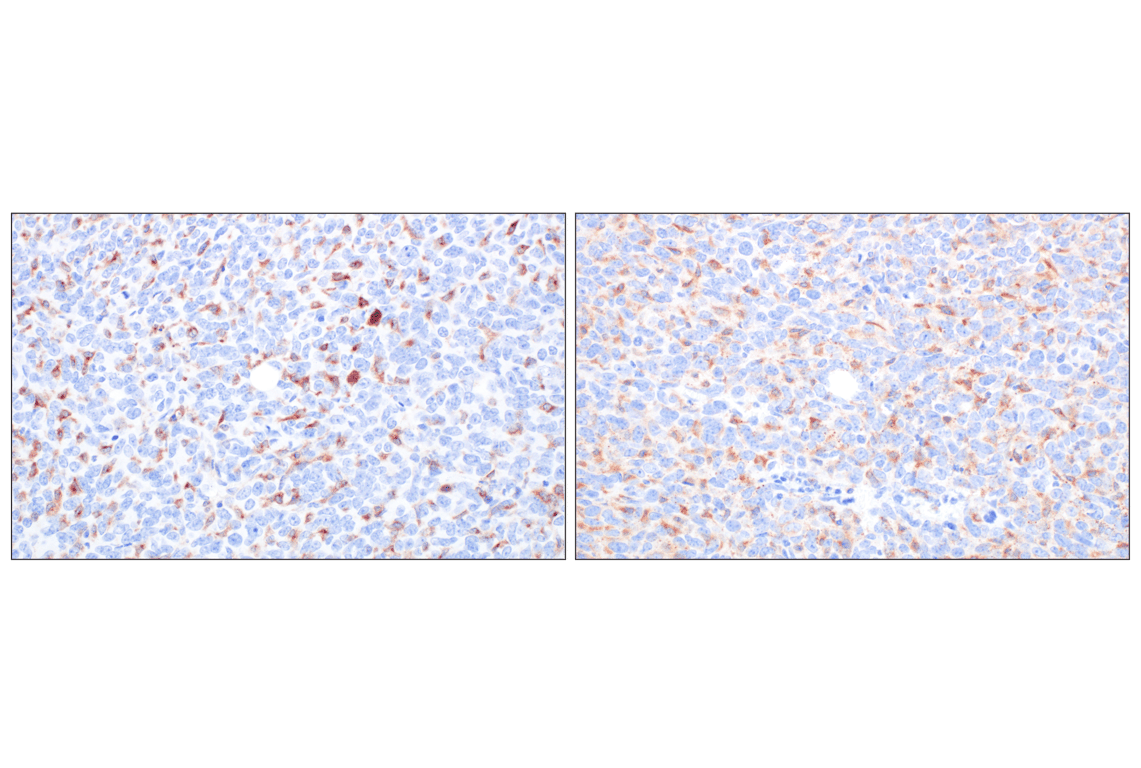 CSF-1R/M-CSF-R (F1H1I) Rabbit Monoclonal Antibody | Cell Signaling