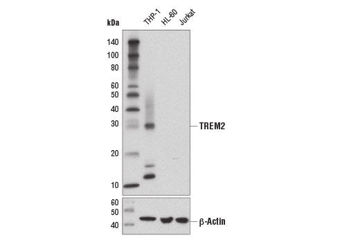 Western Blotting Image 2: TREM2 (D8I4C) Rabbit Monoclonal Antibody (BSA and Azide Free)