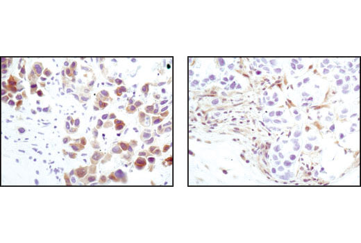 Immunohistochemistry Image 1: PTEN (138G6) Rabbit Monoclonal Antibody (BSA and Azide Free)