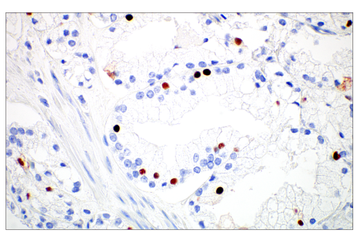 Immunohistochemistry Image 3: MAGE-C2/CT10 (E7B8D) Rabbit Monoclonal Antibody