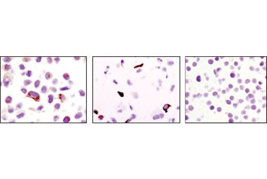 Immunohistochemistry Image 1: Keratin 17/19 (D32D9) Rabbit Monoclonal Antibody