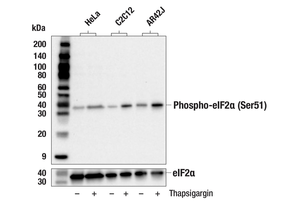 Western Blotting Image 2: Phospho-eIF2 alpha (Ser51) Antibody